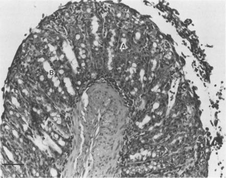 https://cdn.ncbi.nlm.nih.gov/pmc/blobs/7bea/264422/63c6239c872b/iai00135-0341-a.jpg