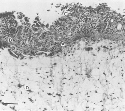 https://cdn.ncbi.nlm.nih.gov/pmc/blobs/7bea/264422/fbf04f9661b8/iai00135-0339-a.jpg