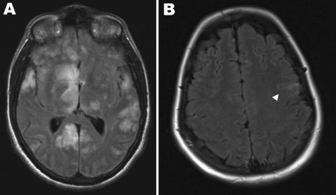 https://cdn.ncbi.nlm.nih.gov/pmc/blobs/7bea/2957996/aa90f818c911/09-0552-F1.jpg