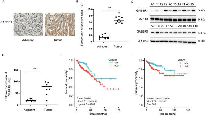 https://cdn.ncbi.nlm.nih.gov/pmc/blobs/7beb/12186342/47c13850ac26/40170_2025_403_Fig5_HTML.jpg