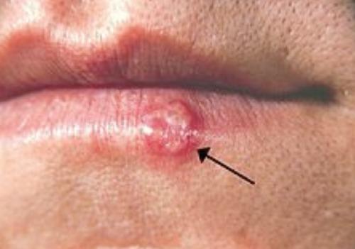 https://cdn.ncbi.nlm.nih.gov/pmc/blobs/7bec/3892662/9a5ae02d8a80/idr-2012-1-e9-g006.jpg