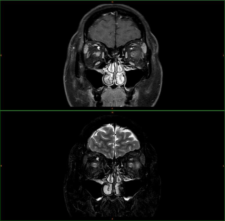 https://cdn.ncbi.nlm.nih.gov/pmc/blobs/7bee/11521472/6c240059f57f/cop-2024-0015-0001-540776_F04.jpg