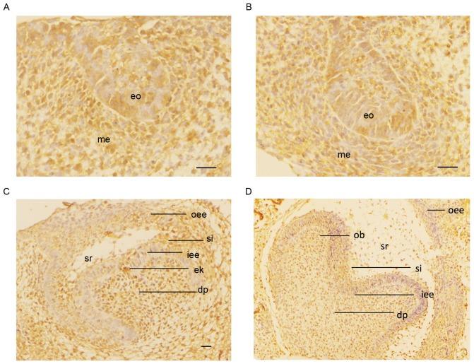 https://cdn.ncbi.nlm.nih.gov/pmc/blobs/7bf0/5639343/5d819ca60bcb/etm-14-04-3507-g00.jpg