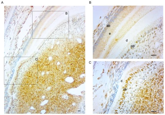 https://cdn.ncbi.nlm.nih.gov/pmc/blobs/7bf0/5639343/837655f9b31a/etm-14-04-3507-g02.jpg