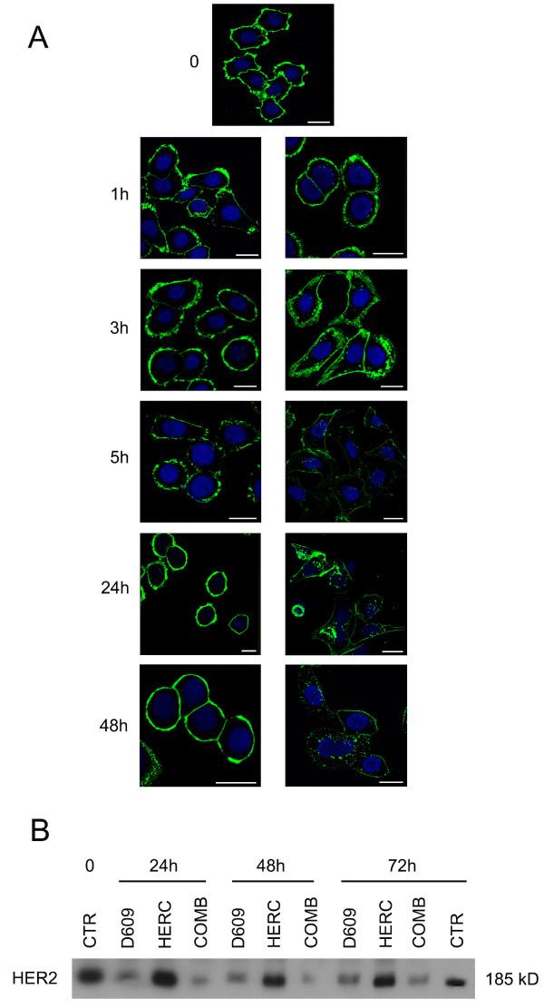 https://cdn.ncbi.nlm.nih.gov/pmc/blobs/7bf2/2917016/8adaaf85e899/bcr2575-7.jpg