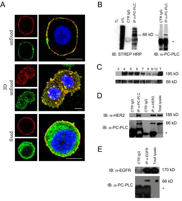 https://cdn.ncbi.nlm.nih.gov/pmc/blobs/7bf2/2917016/b4cf91690b86/bcr2575-2.jpg