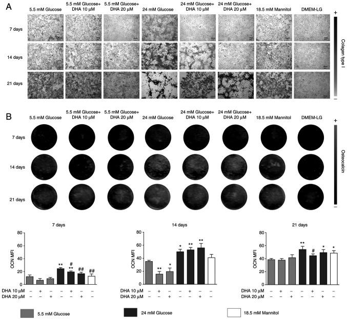 https://cdn.ncbi.nlm.nih.gov/pmc/blobs/7bf6/8815046/29dd0fffc0a8/etm-23-03-11160-g00.jpg