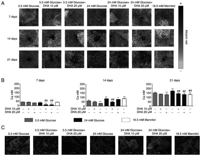 https://cdn.ncbi.nlm.nih.gov/pmc/blobs/7bf6/8815046/dd77d30dbfb8/etm-23-03-11160-g03.jpg