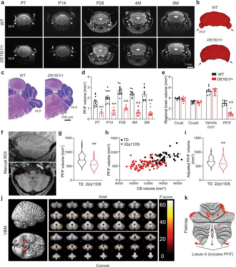https://cdn.ncbi.nlm.nih.gov/pmc/blobs/7bf8/11621701/28b1f7ef793f/41467_2024_54837_Fig1_HTML.jpg