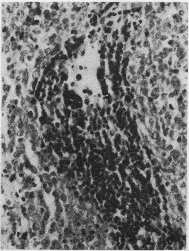 https://cdn.ncbi.nlm.nih.gov/pmc/blobs/7bfd/502577/86c2207c2407/jclinpath00397-0023-a.jpg