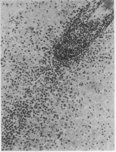 https://cdn.ncbi.nlm.nih.gov/pmc/blobs/7bfd/502577/c9799da9301e/jclinpath00397-0022-b.jpg