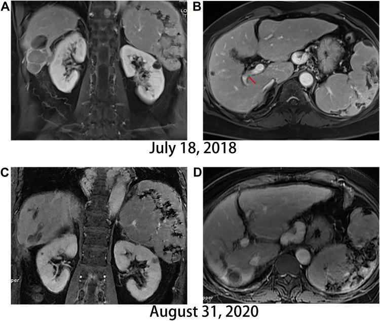 https://cdn.ncbi.nlm.nih.gov/pmc/blobs/7bfd/9250789/7bf1c336343d/OTT-15-703-g0002.jpg