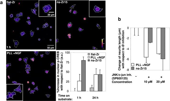 https://cdn.ncbi.nlm.nih.gov/pmc/blobs/7bff/4784317/b481f24acce4/12951_2016_171_Fig8_HTML.jpg