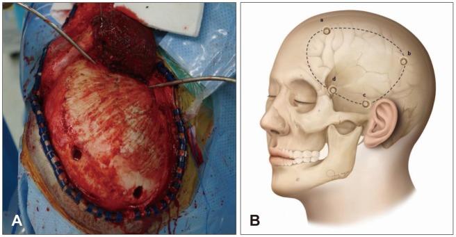 https://cdn.ncbi.nlm.nih.gov/pmc/blobs/7c00/6218355/992d4f7e2290/kjn-14-99-g001.jpg