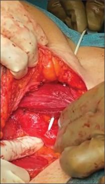 https://cdn.ncbi.nlm.nih.gov/pmc/blobs/7c01/12007848/21d7dc7a9f89/SJA-19-227-g002.jpg