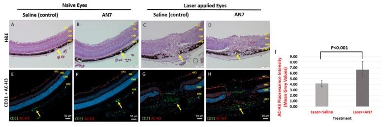 https://cdn.ncbi.nlm.nih.gov/pmc/blobs/7c06/6387404/0e333a00aaed/ijms-20-00714-g001.jpg