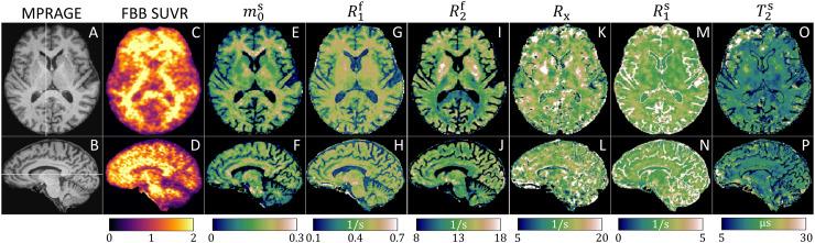 https://cdn.ncbi.nlm.nih.gov/pmc/blobs/7c13/12315764/d29112334712/imag_a_00367_fig2.jpg