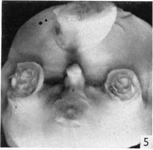 https://cdn.ncbi.nlm.nih.gov/pmc/blobs/7c19/1244859/4c1ad5c5d951/janat00458-0018-d.jpg