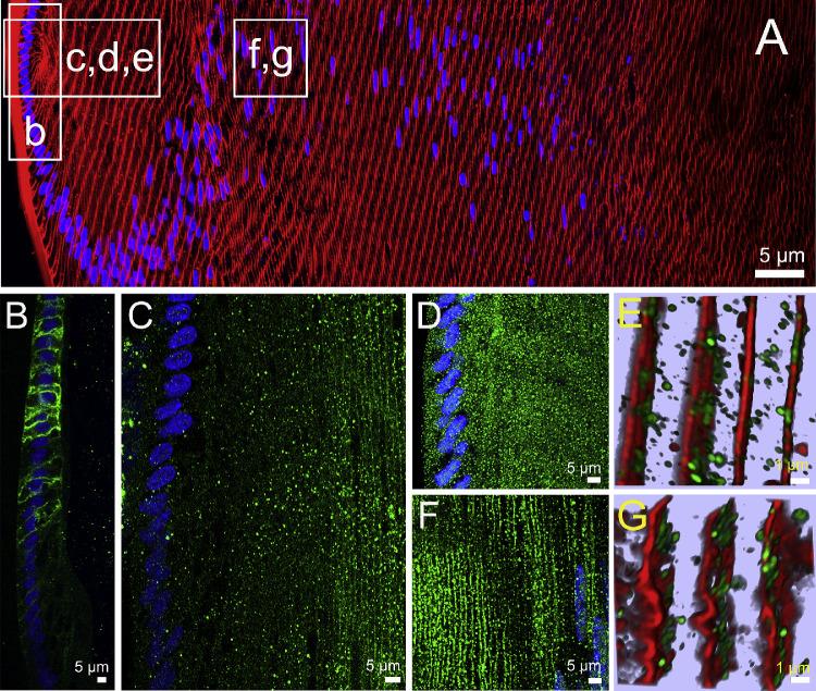 https://cdn.ncbi.nlm.nih.gov/pmc/blobs/7c22/7509773/3eca48e7262b/iovs-61-11-36-f002.jpg