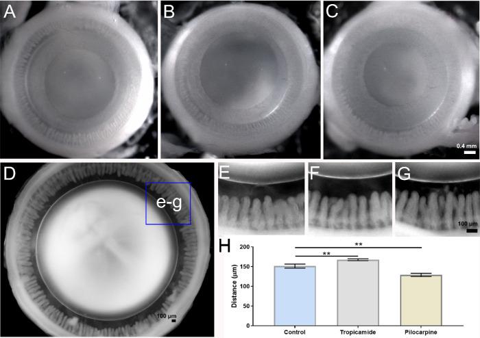 https://cdn.ncbi.nlm.nih.gov/pmc/blobs/7c22/7509773/56beb5e90dda/iovs-61-11-36-f004.jpg