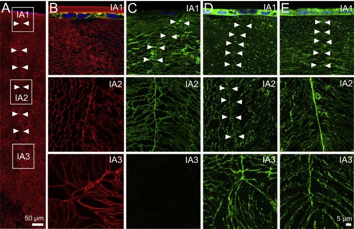 https://cdn.ncbi.nlm.nih.gov/pmc/blobs/7c22/7509773/ade4dffd4b1c/iovs-61-11-36-f007.jpg
