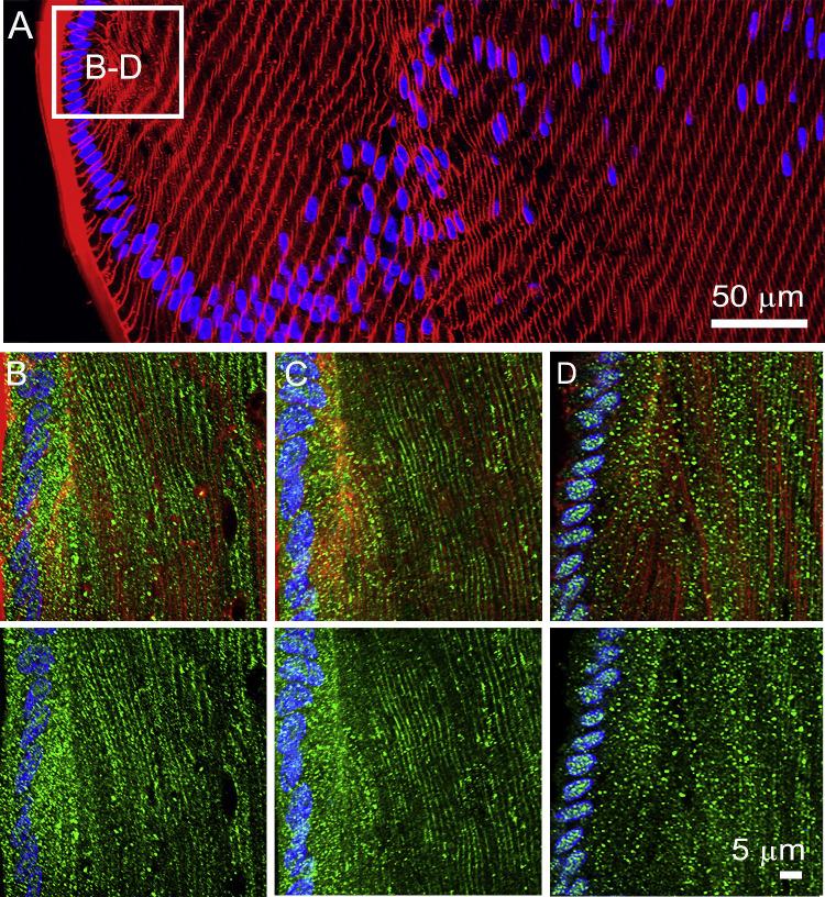https://cdn.ncbi.nlm.nih.gov/pmc/blobs/7c22/7509773/cc61f1669f9c/iovs-61-11-36-f005.jpg