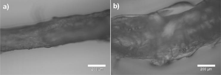 https://cdn.ncbi.nlm.nih.gov/pmc/blobs/7c23/6150646/e7d7734dc2d8/bm-2017-01765t_0002.jpg