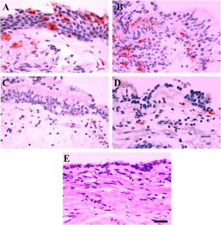 https://cdn.ncbi.nlm.nih.gov/pmc/blobs/7c26/4042510/1ad3b67559c6/chest_145_6_1219_fig01.jpg
