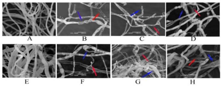 https://cdn.ncbi.nlm.nih.gov/pmc/blobs/7c2a/9694244/b070f298c338/nanomaterials-12-04002-g006.jpg