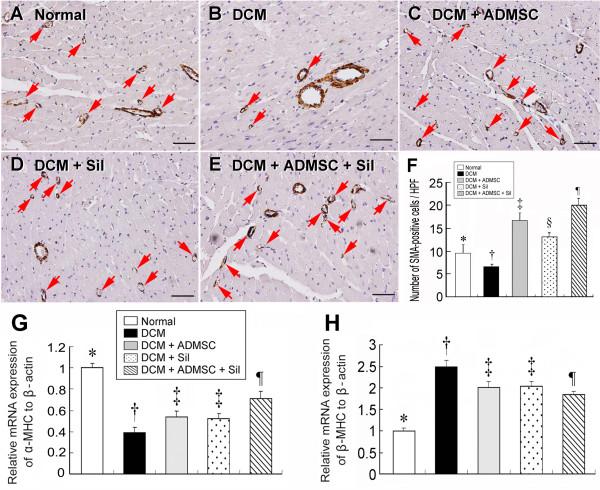https://cdn.ncbi.nlm.nih.gov/pmc/blobs/7c2f/2956711/980aa90afa43/1479-5876-8-88-7.jpg