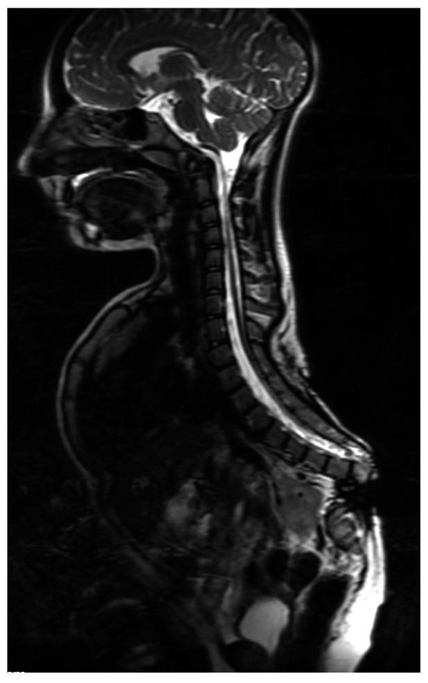 https://cdn.ncbi.nlm.nih.gov/pmc/blobs/7c48/10047641/5cc91da43d61/children-10-00589-g007.jpg