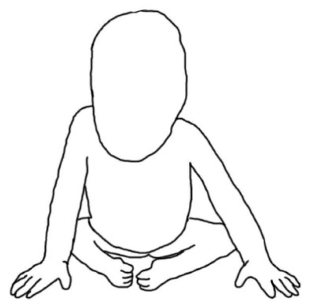 https://cdn.ncbi.nlm.nih.gov/pmc/blobs/7c48/10047641/ff053e039500/children-10-00589-g002.jpg