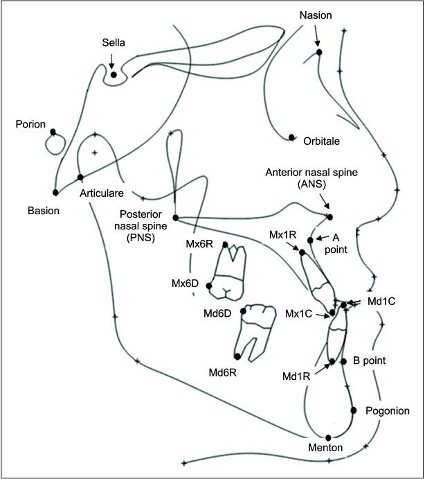 https://cdn.ncbi.nlm.nih.gov/pmc/blobs/7c51/9314217/5dee95529f2e/kjod-52-4-287-f3.jpg