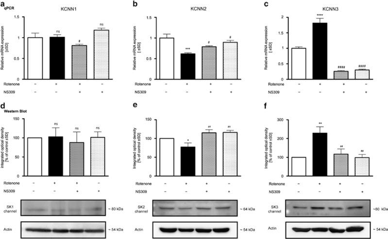 https://cdn.ncbi.nlm.nih.gov/pmc/blobs/7c52/4040692/188fcc85077c/cddis2013530f4.jpg