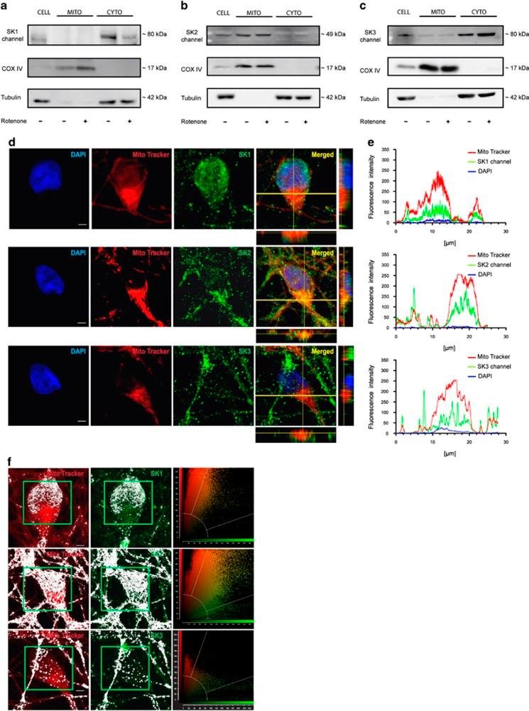 https://cdn.ncbi.nlm.nih.gov/pmc/blobs/7c52/4040692/72cb6c881db5/cddis2013530f5.jpg