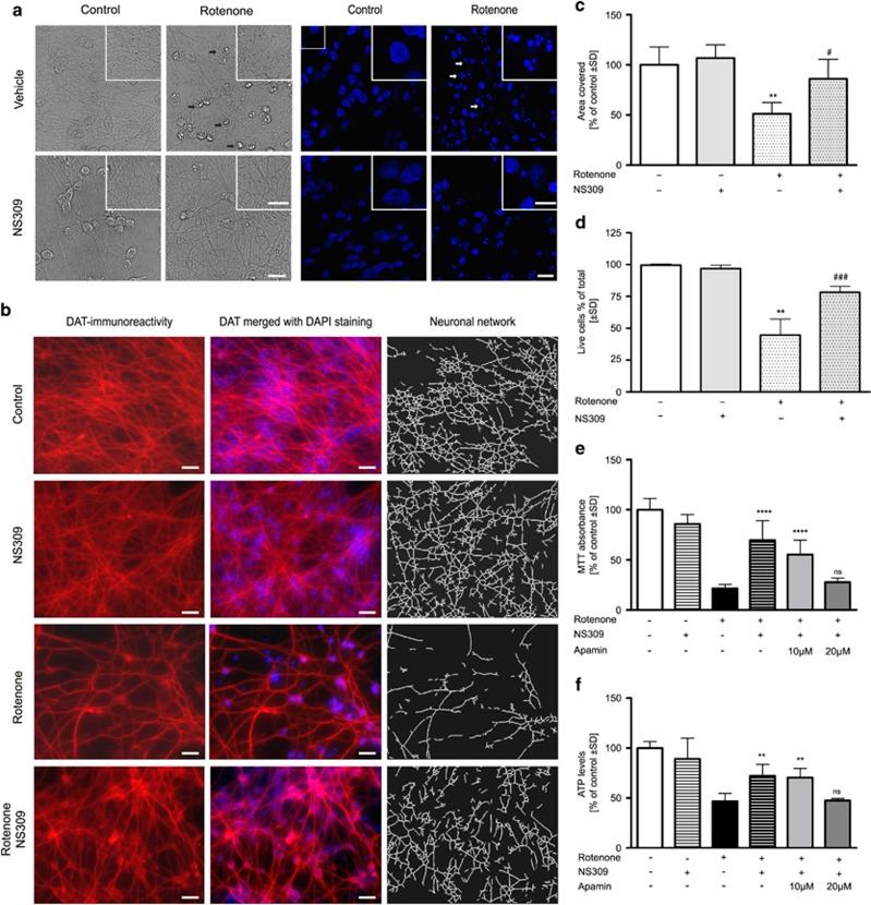 https://cdn.ncbi.nlm.nih.gov/pmc/blobs/7c52/4040692/9e64155b6bfb/cddis2013530f3.jpg