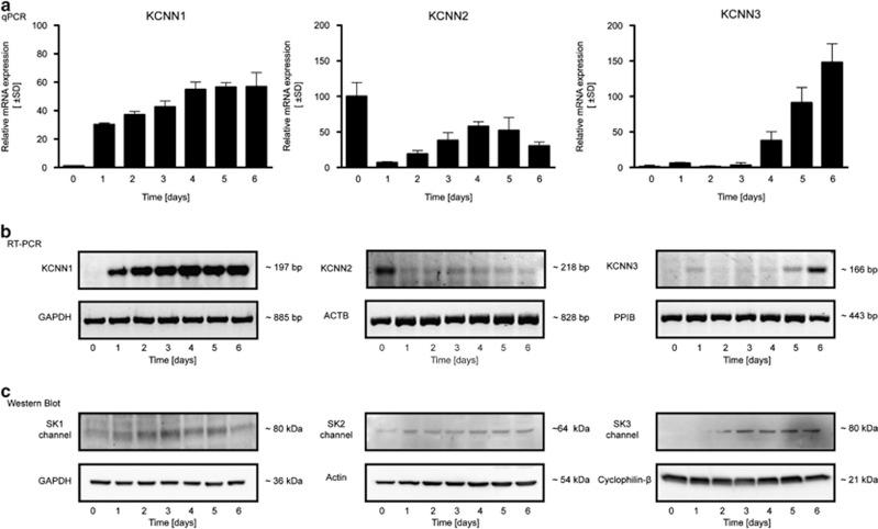 https://cdn.ncbi.nlm.nih.gov/pmc/blobs/7c52/4040692/a318378e09cb/cddis2013530f1.jpg