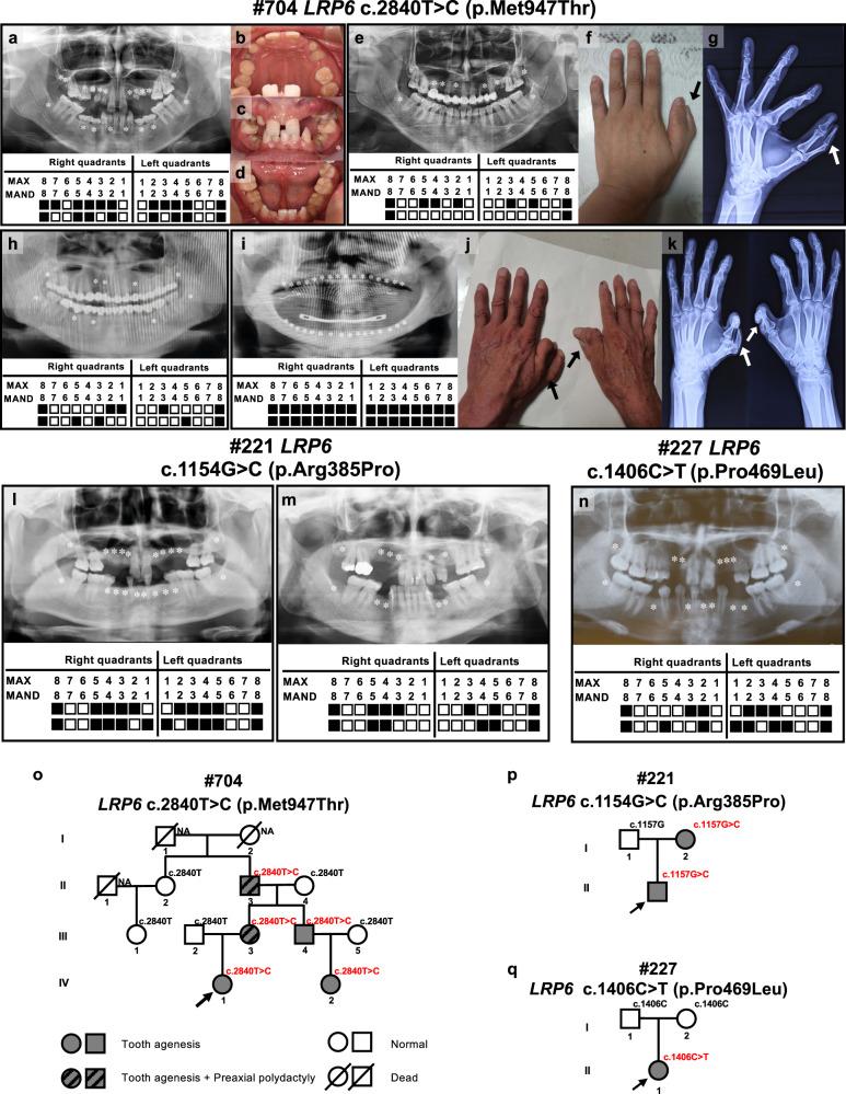 https://cdn.ncbi.nlm.nih.gov/pmc/blobs/7c54/8581002/aa46aa946614/41525_2021_262_Fig1_HTML.jpg