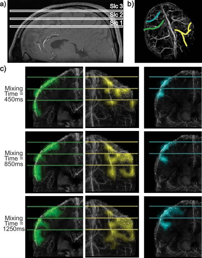 https://cdn.ncbi.nlm.nih.gov/pmc/blobs/7c5a/12022259/15eb49a2c4b5/41467_2025_59108_Fig9_HTML.jpg