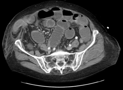 https://cdn.ncbi.nlm.nih.gov/pmc/blobs/7c62/3134703/617436f4282a/jls0011127030001.jpg