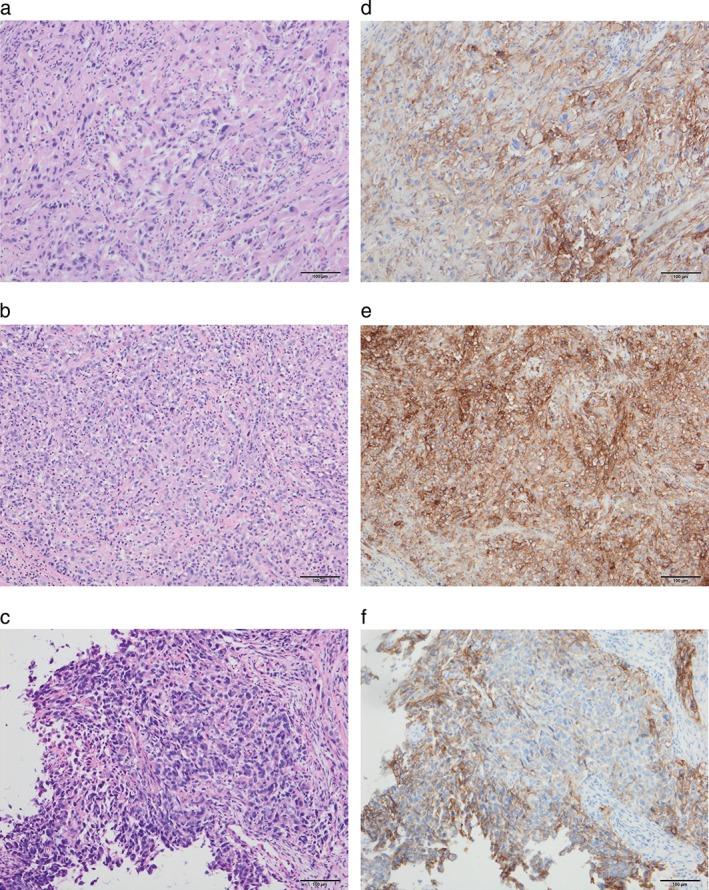 https://cdn.ncbi.nlm.nih.gov/pmc/blobs/7c67/5668504/609b1196fd32/TCA-8-724-g001.jpg