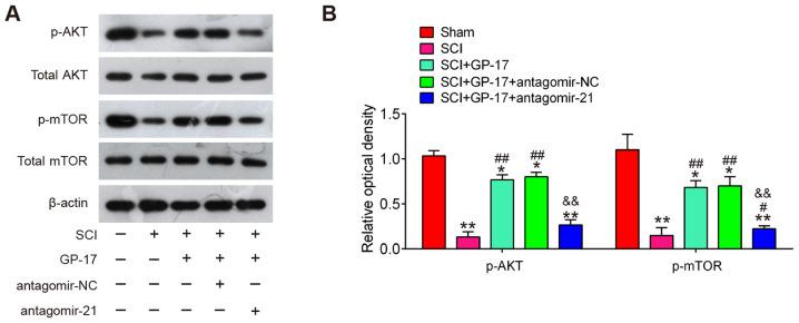 https://cdn.ncbi.nlm.nih.gov/pmc/blobs/7c69/8208621/9c7f0e3683bf/IJMM-48-02-04979-g05.jpg