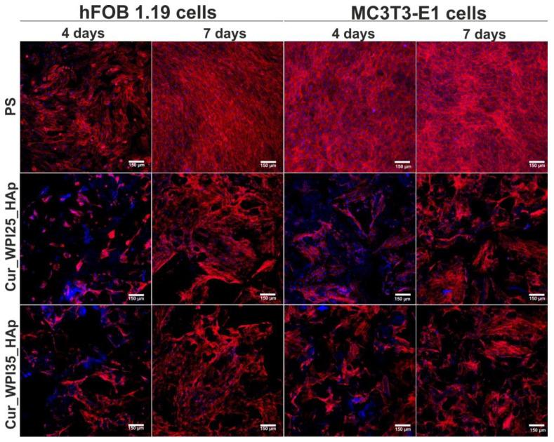 https://cdn.ncbi.nlm.nih.gov/pmc/blobs/7c6a/9600130/46ca19256b68/cells-11-03251-g009.jpg