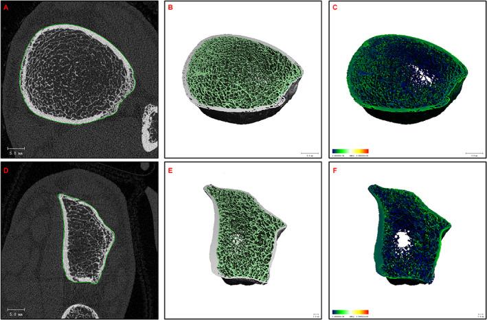 https://cdn.ncbi.nlm.nih.gov/pmc/blobs/7c6f/10494497/a20f70a870f7/JBM4-7-e10791-g001.jpg