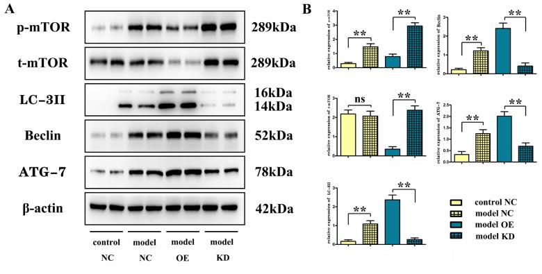 https://cdn.ncbi.nlm.nih.gov/pmc/blobs/7c75/10497003/b6a089187040/aging-15-204971-g003.jpg