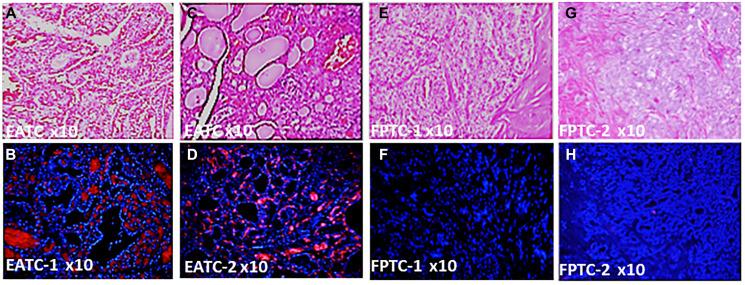https://cdn.ncbi.nlm.nih.gov/pmc/blobs/7c75/8021030/961ff0dac072/oncotarget-12-596-g001.jpg