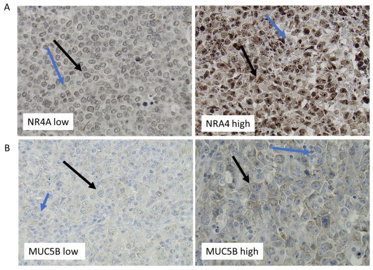 https://cdn.ncbi.nlm.nih.gov/pmc/blobs/7c77/9954534/0627ca745c69/cancers-15-01298-g005.jpg