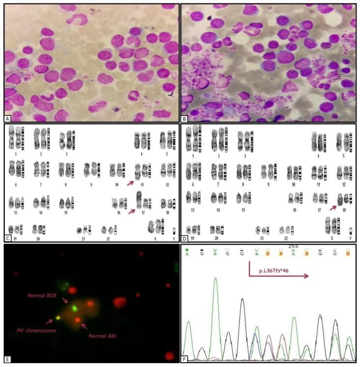 https://cdn.ncbi.nlm.nih.gov/pmc/blobs/7c7e/4696471/df80b978cbca/mjhid-8-1-e2016002f1.jpg