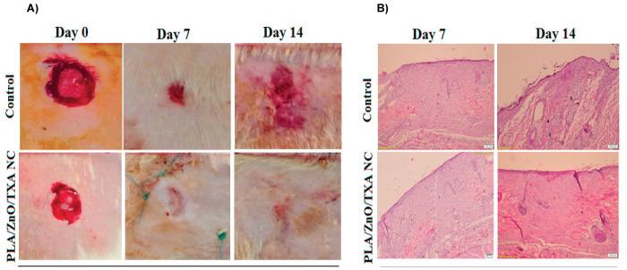https://cdn.ncbi.nlm.nih.gov/pmc/blobs/7c81/8590716/4f359a8cfc03/IJB-19-e2737-g005.jpg