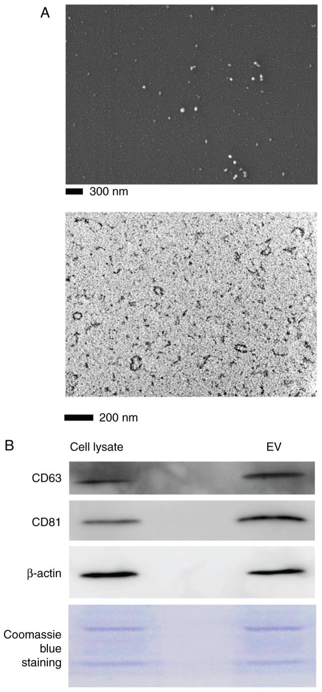 https://cdn.ncbi.nlm.nih.gov/pmc/blobs/7c84/8559701/38f46969a9e3/IJMM-48-06-05054-g01.jpg